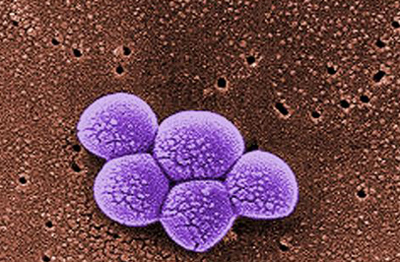 Methicillin resistant Staphylococcus aureus