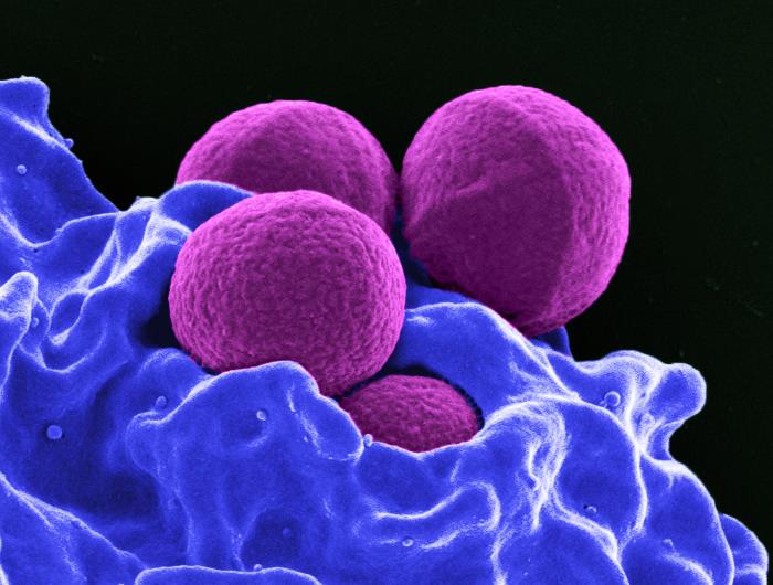 a close look at staphylococcus aureus